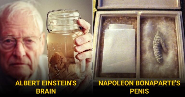 5 Famous People And The Reason Why Their Organs Are Kept