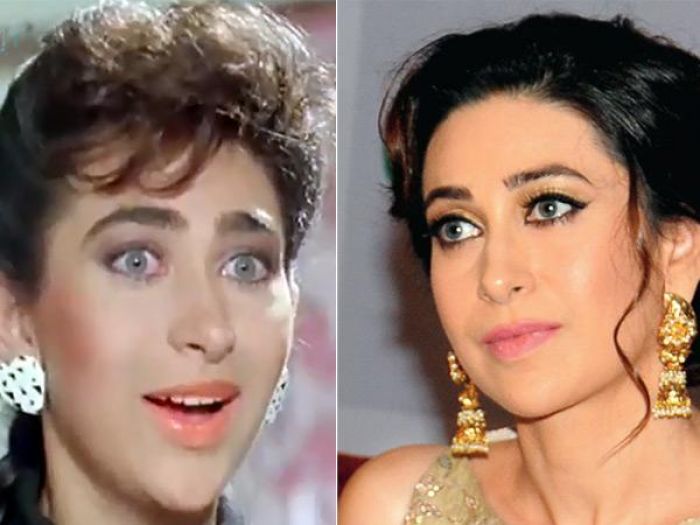 Karishma Kapoor plastic surgery