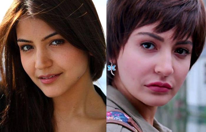 Anushka Sharma plastic surgery