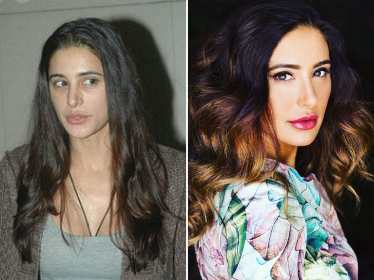 11 Bollywood Actresses Who Have Undergone Plastic Surgery