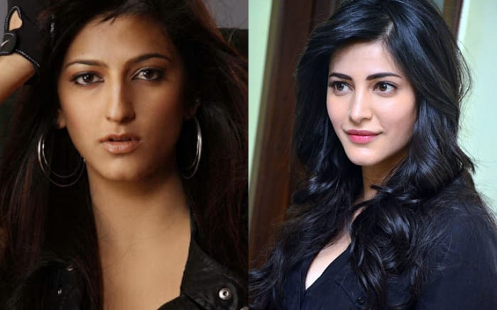 Shruti Hassan plastic surgery