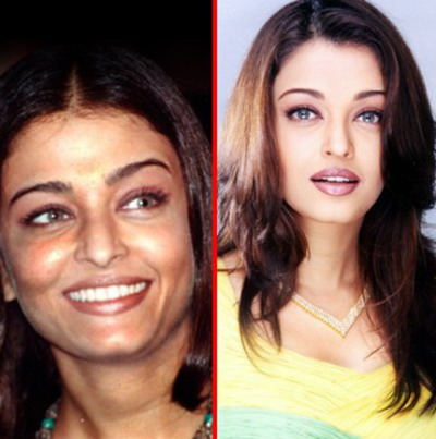 indian celebrity botox before and after