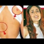 kareenas-love-bite