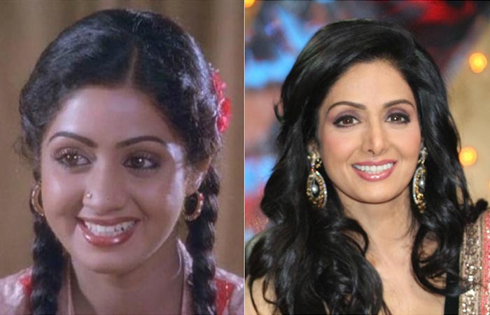 Sridevi underwent plastic surgery to look young