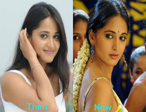 anushka shetty plastic surgery