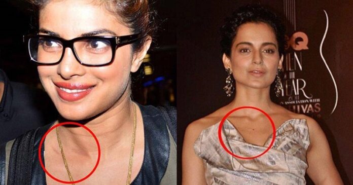 Love Bites Of Bollywood celebrities