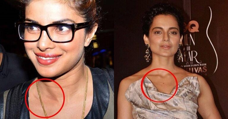 13 Bollywood Celebrities Who Were Snapped With Hickeys & Love Bites