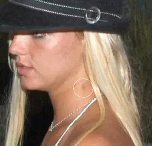 britney spears hickey