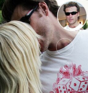 dean mcdermott love bite