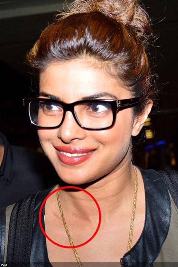 priyanka chopra hickey