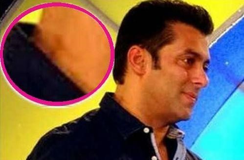 love bites on bollywood celeb salman khan