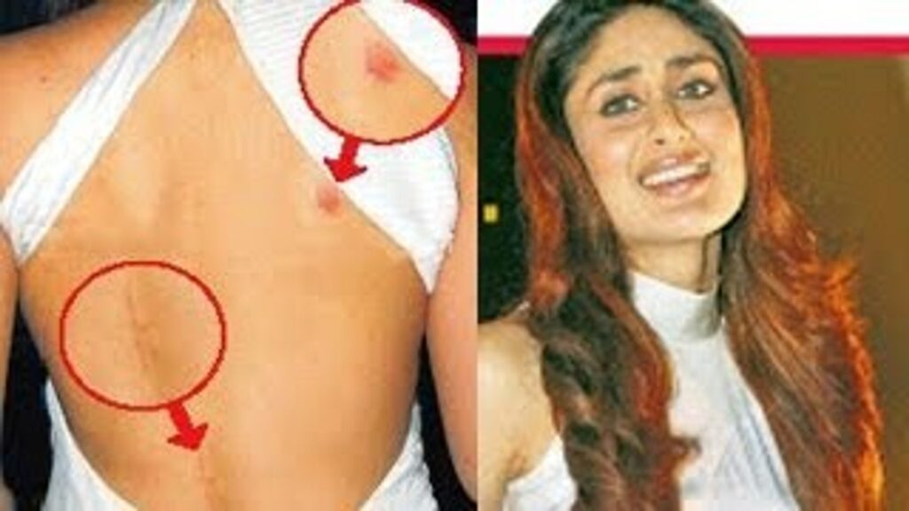 love bites of bollywood celebrity kareena kapoor