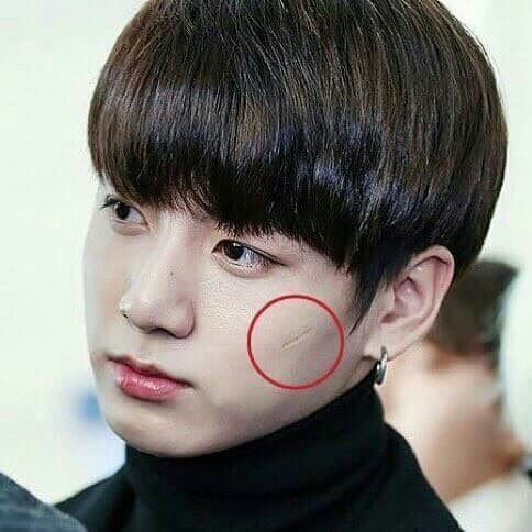 Jungkook's face scar mark