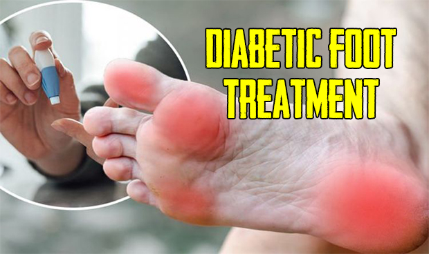 Diabetic Foot