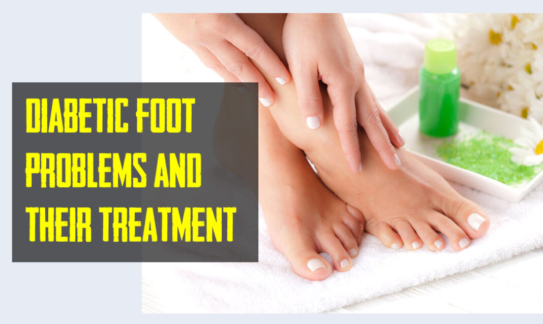 Common Diabetic Foot Problems And Their Treatment