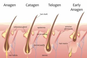 It is not uncommon to lose between 50 to 100 strands of hair daily. A significant hair fall is when you are losing more than 100 strands of hair daily this is called hair loss. Hence the reason why you need to know the hair loss causes. hair loss, hair loss reasons, hair loss reasons in females, hair loss in men, hair loss for men, hair loss vs hair fall, reasons of hair loss in females, hair loss causes vitamin deficiency, excessive hair loss reasons, for hair loss which doctor, what are the reasons of hair loss,