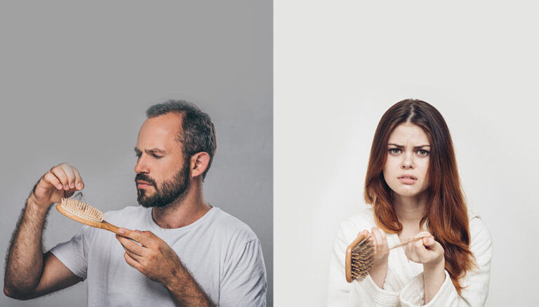 Hair Loss Reasons: Why Men and Women Lose Their Hair