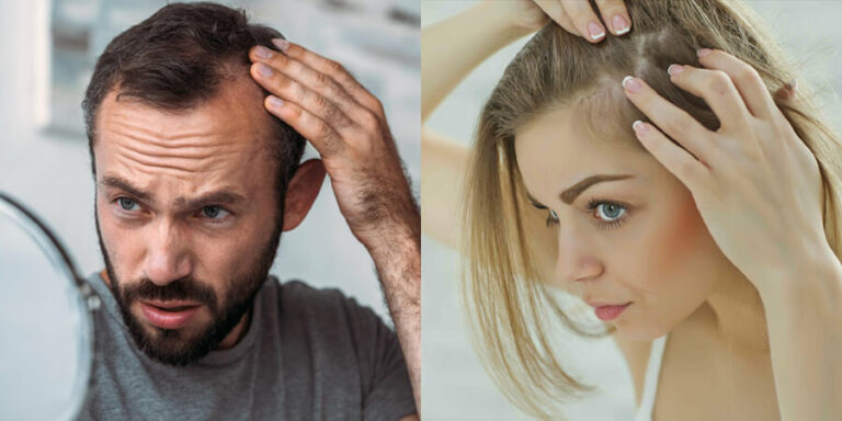 Hair Fall Home Remedy: Top 5 Effective Solutions To Try