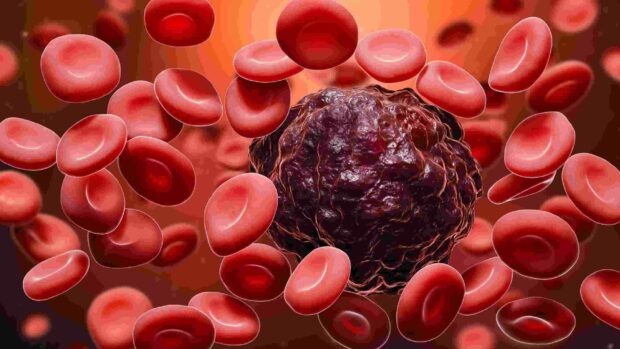 Blood Cancer - Types Of Cancer