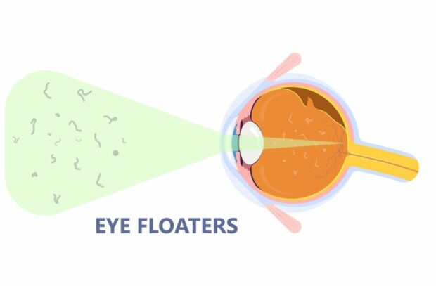 Eye Floaters - Mews