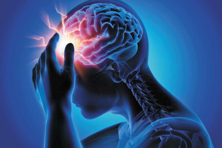 5 Types Of Headache That Might Be Behind Your Migraines